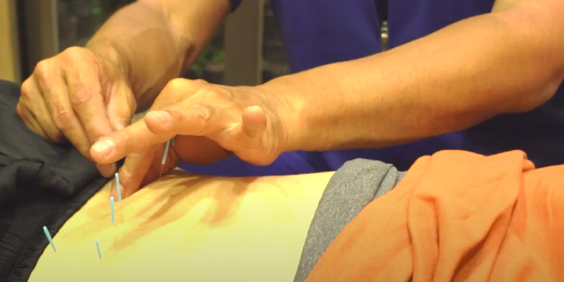 鍼灸治療とは？